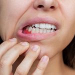 Bleeding Gums: Causes and Fixes from Your Brighton Dentist