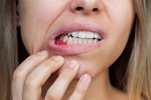 Bleeding Gums: Causes and Fixes from Your Brighton Dentist